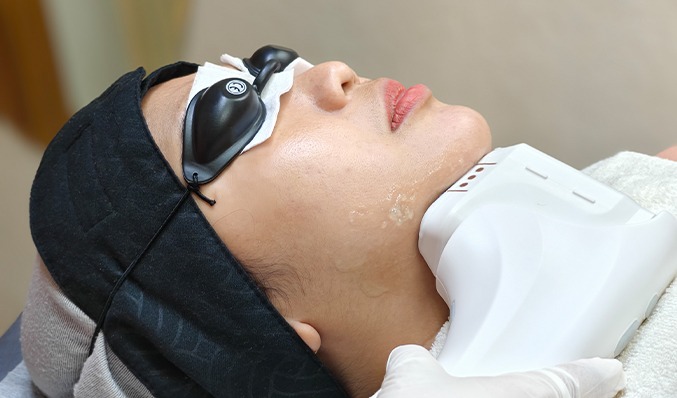 Platelet-Rich Fibrin (PRF)